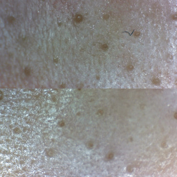 Диагностика кожи,профессиональная работа с причинно следстве