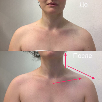 Массаж Угол молодости (лицо, шея, декольте)
                    Косметолог Елена Ивано-Франковск