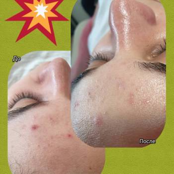 Альбина Михова , Одесса Фото - 33