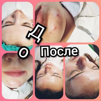 Альбина Михова , Одесса Фото - 34