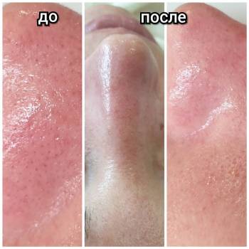 Альбина Михова , Одесса Фото - 36