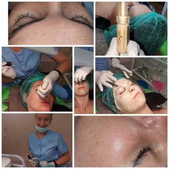 Альбина Михова , Одесса Фото - 37