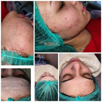 Альбина Михова , Одесса Фото - 38