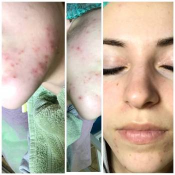 Альбина Михова , Одесса Фото - 41