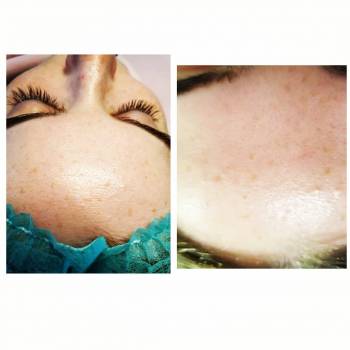 Альбина Михова , Одесса Фото - 43