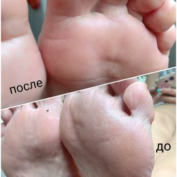 Фото с портфолио Евгения Федирко