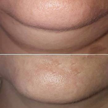 Bright, Винница Фото - 8