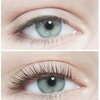 Bright, Винница Фото - 6