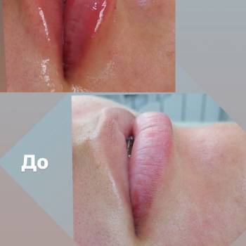 Dr. Liza , Одеса Фото - 34