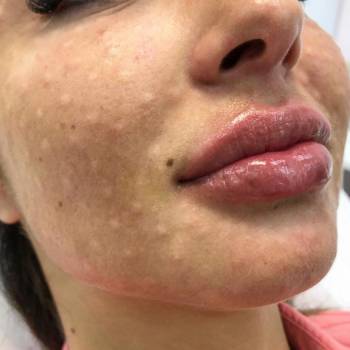 Dr. Liza , Одеса Фото - 37