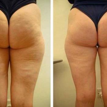 Dr. Liza , Одеса Фото - 40