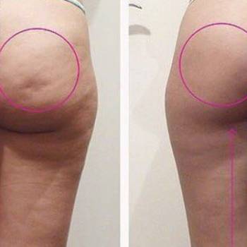 Dr. Liza , Одеса Фото - 30