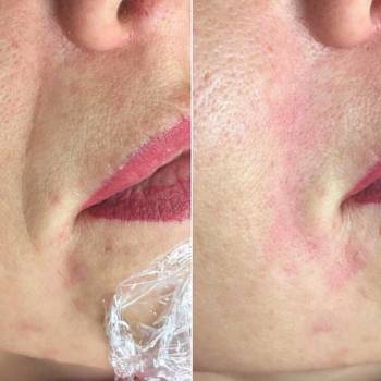 Dr. Liza , Одеса Фото - 44