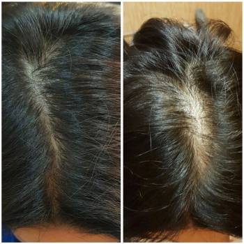 Dr. Liza , Одеса Фото - 46