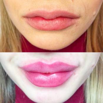 Dr. Liza , Одеса Фото - 54