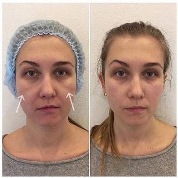 Академия эстетики и красоты, Чернігів Фото - 21