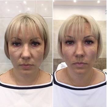 Академия эстетики и красоты, Чернігів Фото - 20