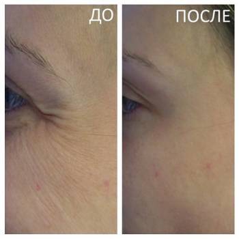 Академия эстетики и красоты, Чернігів Фото - 19