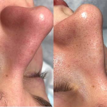 Академия эстетики и красоты, Чернігів Фото - 18