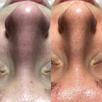 Академия эстетики и красоты, Чернігів Фото - 17