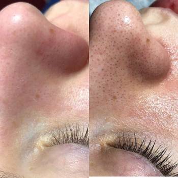 Академия эстетики и красоты, Чернігів Фото - 16