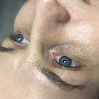 ПМ глаз - межресничка