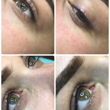 ПМ глаз - межресничка