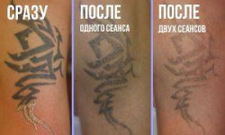 Удаление тату и татуажа Тату майстер Анастасия Херсон