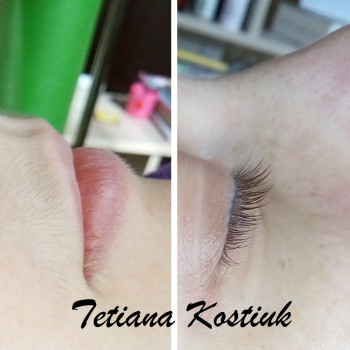 комбинированная чистка лица (ультразвук+мануально)