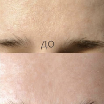 Фото с портфолио Любчик 