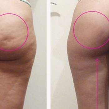 Светлана Лазаренко Світлана, Кропивницкий Фото - 5