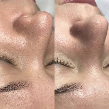 Фото с портфолио Дарья Тиодорова 