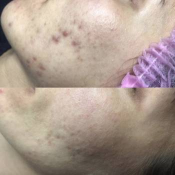 Фото с портфолио Дарья Тиодорова 