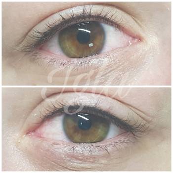 Игла, Днепр Фото - 34