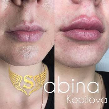 Фото из портфолио косметолога Сабина Копилова (Харьков)