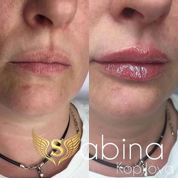 Фото из портфолио косметолога Сабина Копилова (Харьков)