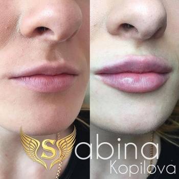 Фото из портфолио косметолога Сабина Копилова (Харьков)