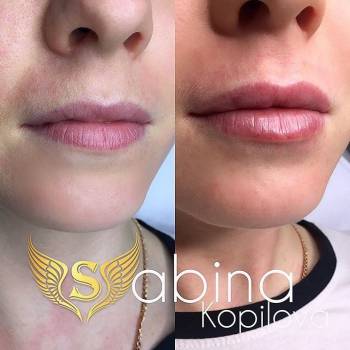 Фото из портфолио косметолога Сабина Копилова (Харьков)