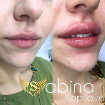 Фото из портфолио косметолога Сабина Копилова (Харьков)