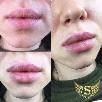 Фото из портфолио косметолога Сабина Копилова (Харьков)