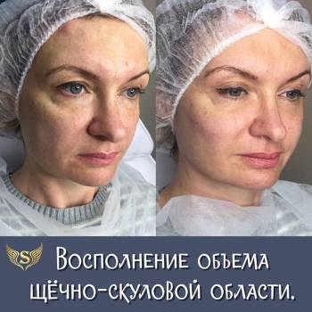 Фото из портфолио косметолога Сабина Копилова (Харьков)