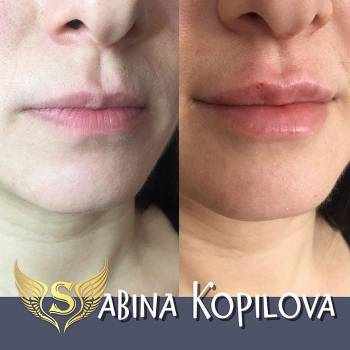 Фото из портфолио косметолога Сабина Копилова (Харьков)