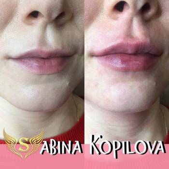 Фото из портфолио косметолога Сабина Копилова (Харьков)