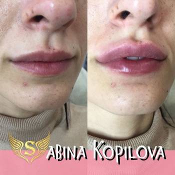 Фото из портфолио косметолога Сабина Копилова (Харьков)