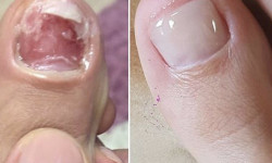 Подология Медичний центр Suda Суми