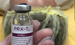 Пилинг Prx t-33 Косметолог Алина Савкина Харків