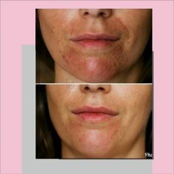 Анна Ковальчук , Київ Фото - 6