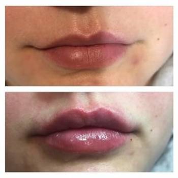 Анна Клименко, Київ Фото - 5