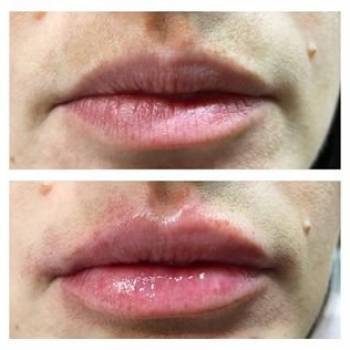 Анна Клименко, Київ Фото - 6