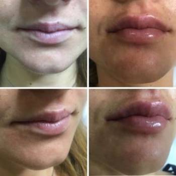 Елена Кузьменко , Київ Фото - 5